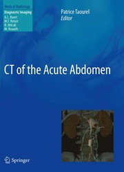 CT of the acute abdomen