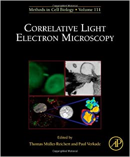 Correlative light and electron microscopy