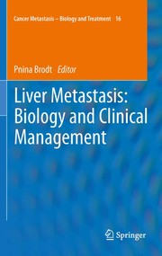 Liver metastasis biology and clinical management