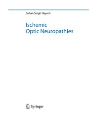 Ischemic optic neuropathies