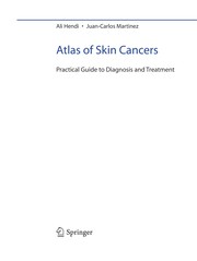 Atlas of skin cancers practical guide to diagnosis and treatment