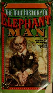 The true history of the Elephant Man