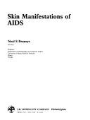Skin manifestations of AIDS