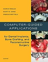 Computer-guided applications : for dental implants, bone  grafting, and reconstructive surgery  /Marco Rinaldi,  Scott D. Ganz, Angelo Mottola ; translation from the Italian by Dr. Stefano Lauriola.