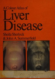 A colour atlas of liver disease